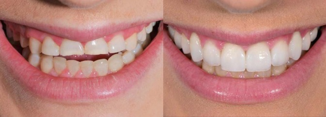 smile gallery